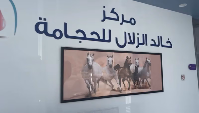 مركز خالد الزلال للحجامة حي الحمراء