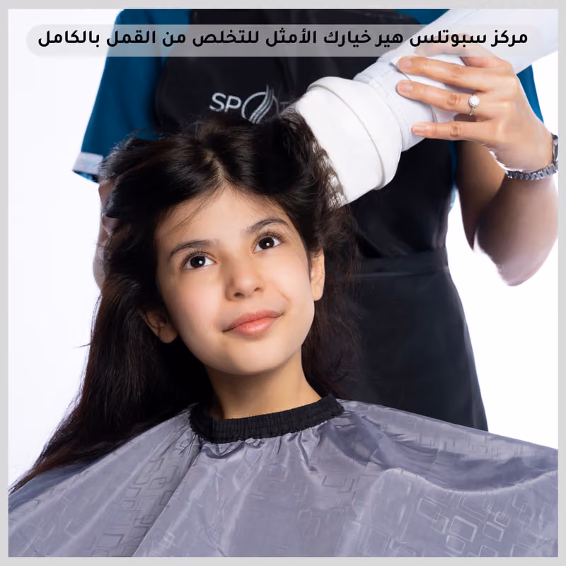 مركز سبوتلس هير لإزالة القمل