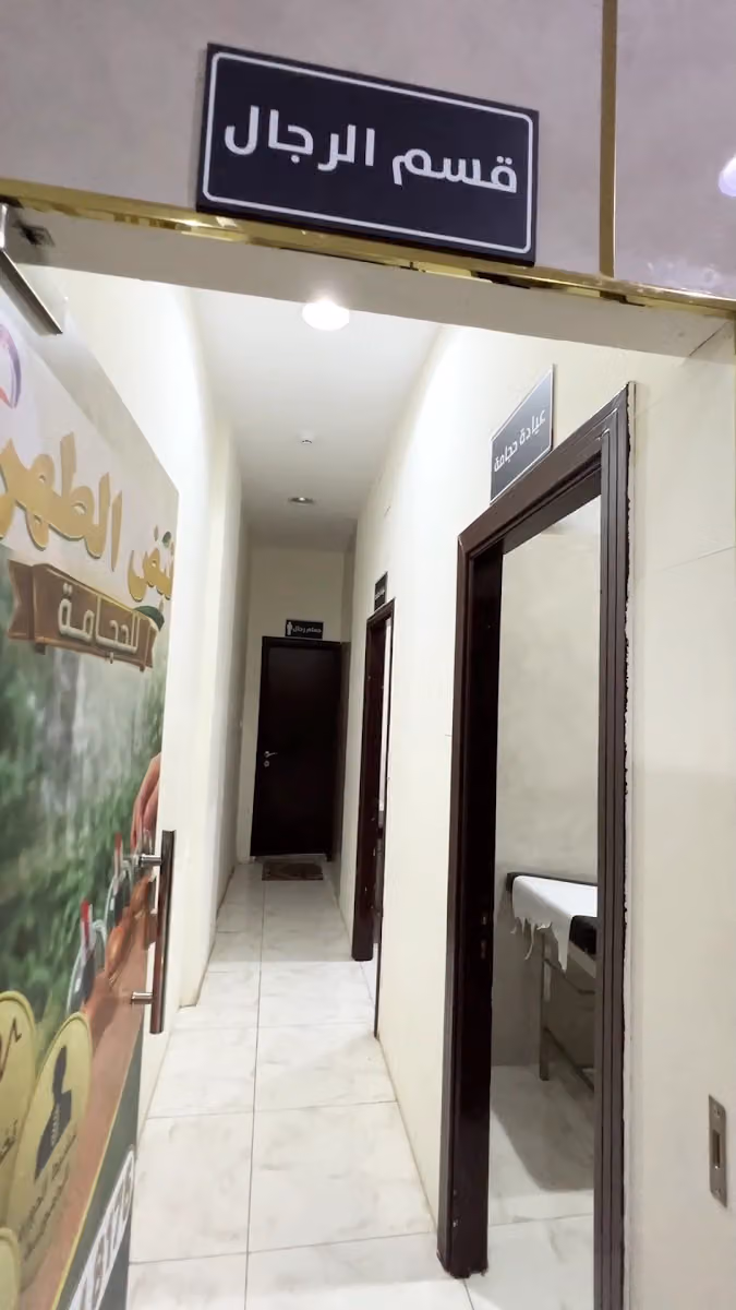مركز صحة البدن للحجامة