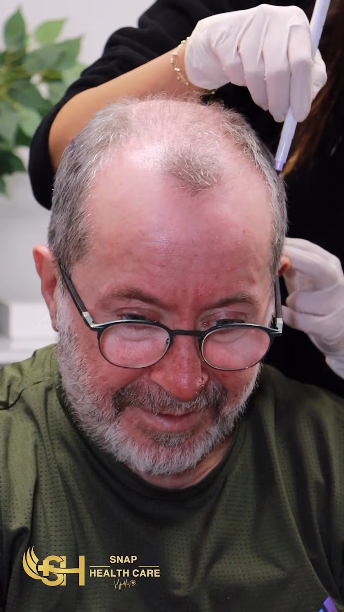 مركز زراعة الشعر سناب كلانك الرياض