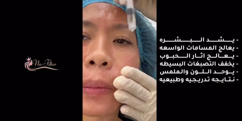 No Filter Clinic| نو فيلتر كلينك