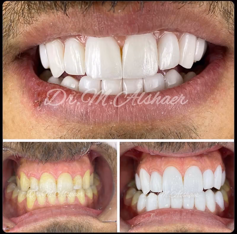صفوة المهيدب لطب الأسنان النظيم