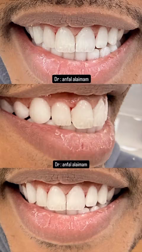 صفوة المهيدب لطب الأسنان النظيم