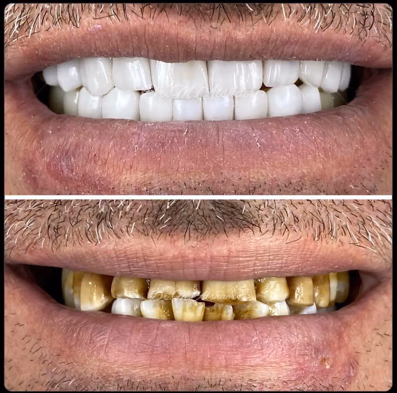 صفوة المهيدب لطب الأسنان النظيم