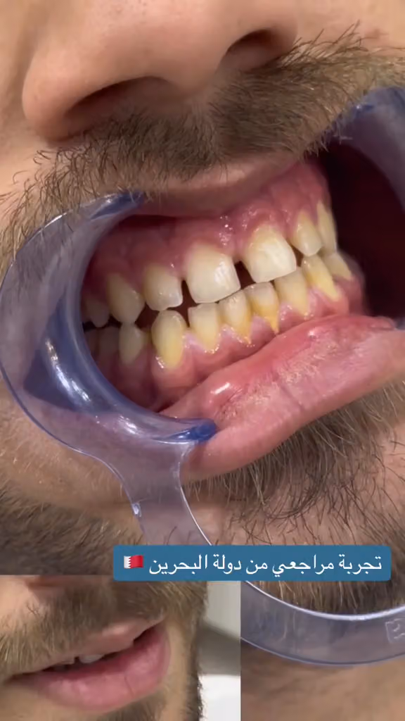 صفوة المهيدب لطب الاسنان اشبيليا