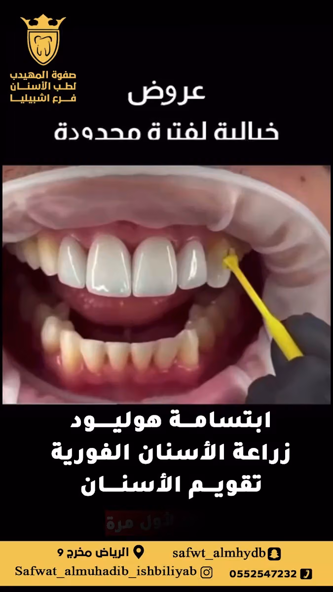 صفوة المهيدب لطب الاسنان اشبيليا