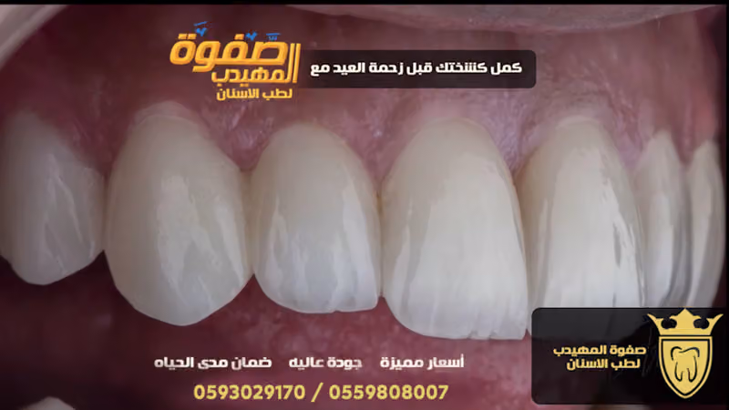 صفوة المهيدب لطب الاسنان حي الحزم