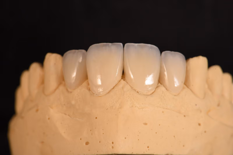 شركة رموز للأسنان - Icons Dental Lab