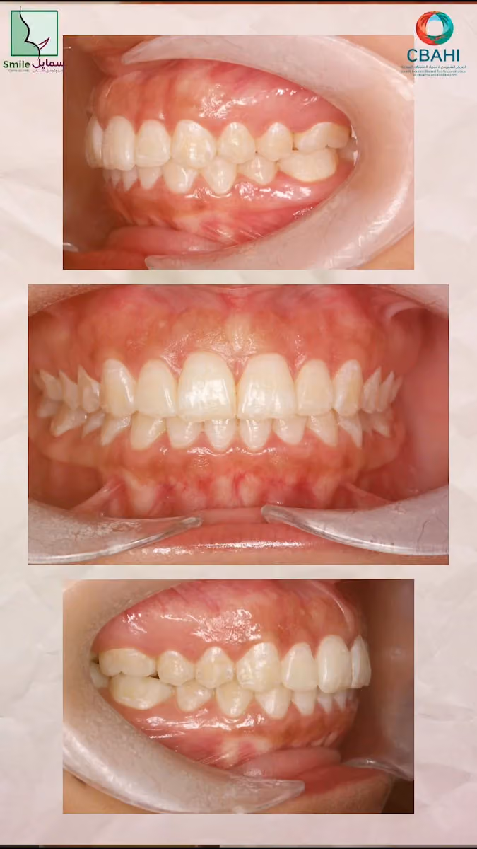 سمايل لطب وتجميل الاسنان