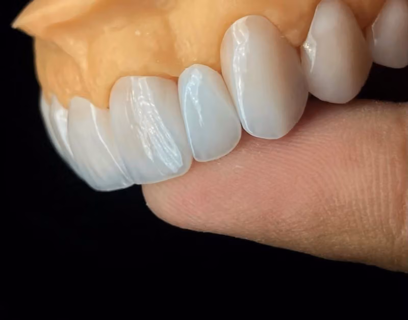Smile Details Dental Lab معمل تفاصيل الابتسامة لتركيبات الأسنان