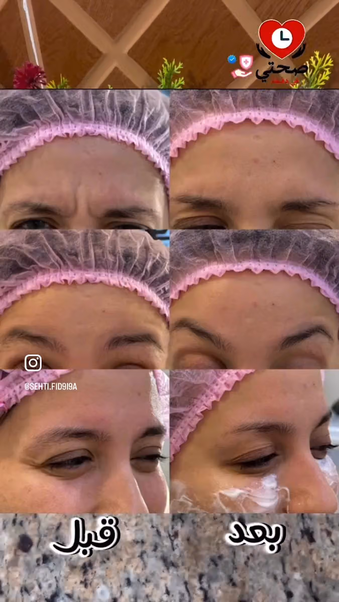 تالا ستار