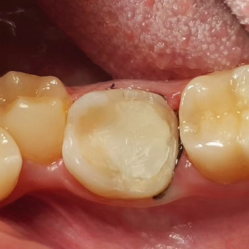 طبيب الأسنان وائل الحسني الجزائري.عيادة أسنان ..DENTIST: Dr.Wael Al hasani Al jazaeri .Dental clinic