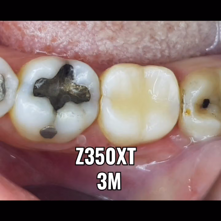 طبيب الأسنان وائل الحسني الجزائري.عيادة أسنان ..DENTIST: Dr.Wael Al hasani Al jazaeri .Dental clinic