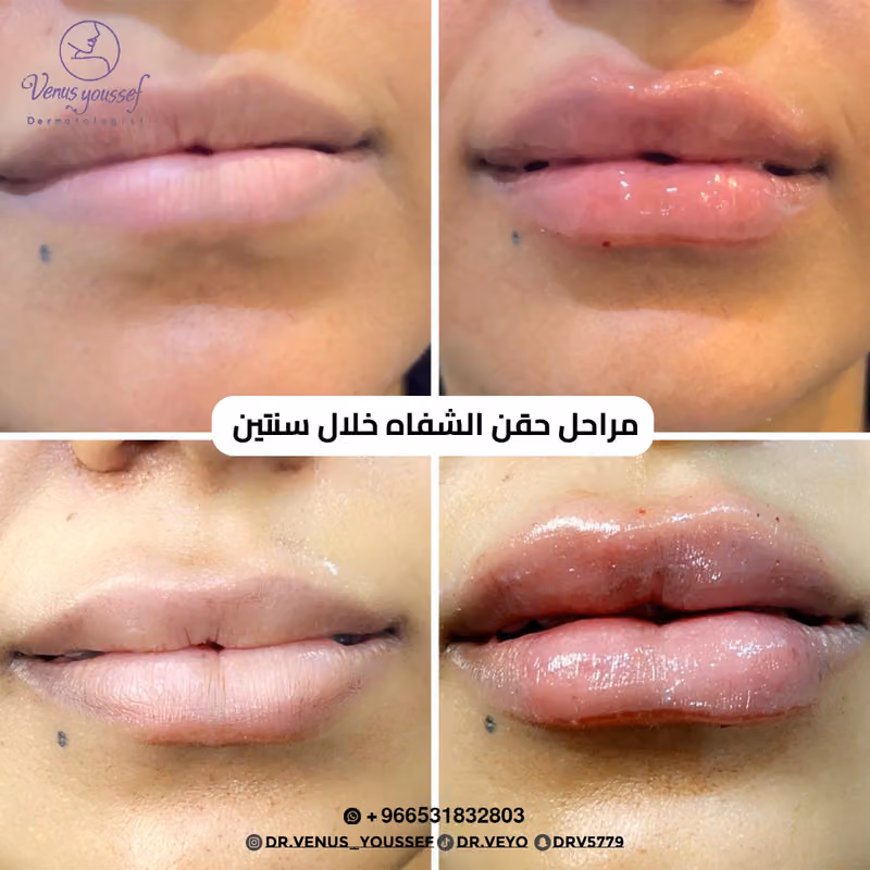 Venus beauty Clinics