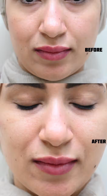 Venus beauty Clinics